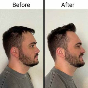 Toppik Best Volumizing Hair Texture Powder Before & After
